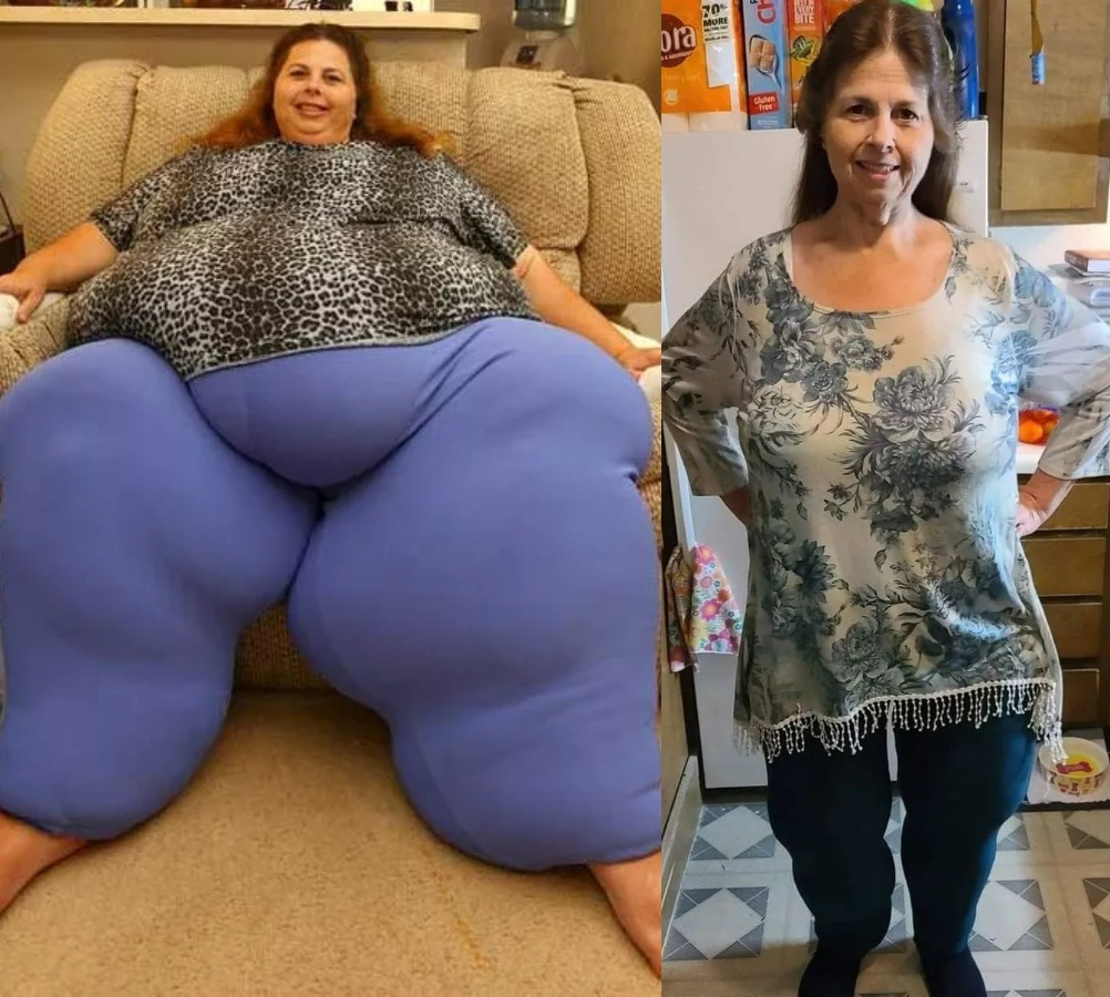 This woman lost 518 pounds at 57 and here is what she looks like after…